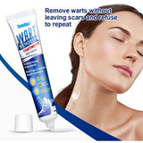 Warts® Tratamiento para pecas, manchas y Verrugas