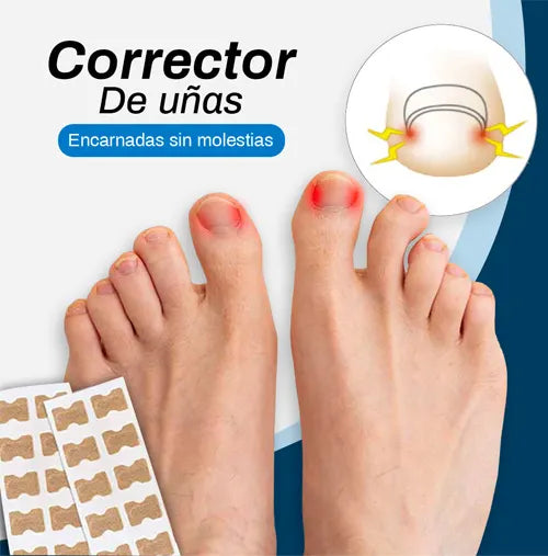 Parches correctores de uñas encarnadas 30pcs 🎁PROMO ESPECIAL🎁