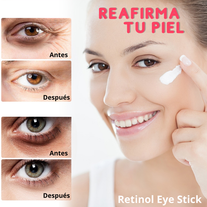 Retinol Eye Stick - Elimina Ojeras y Bolsas