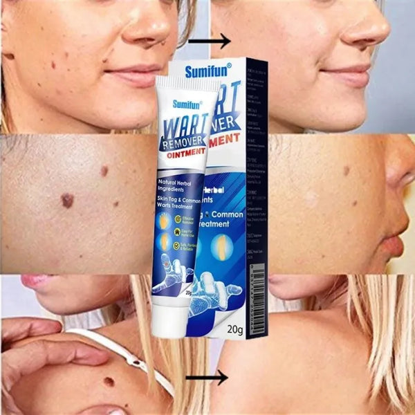 Warts® Tratamiento para pecas, manchas y Verrugas